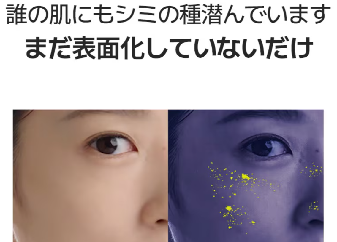 Qoo10-AROCELL-アロセル-4枚-メラTXA-トラネ-スキンケア-10-09-2025_01_34_PM