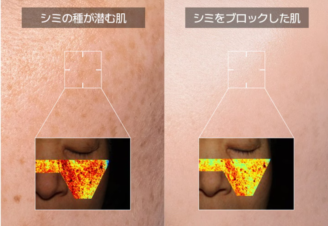 Qoo10-AROCELL-アロセル-4枚-メラTXA-トラネ-スキンケア-10-09-2025_01_36_PM