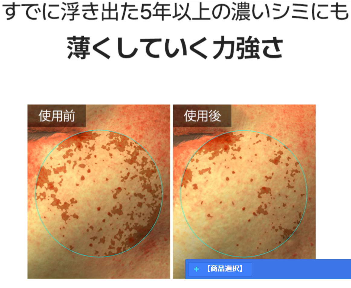 Qoo10-AROCELL-アロセル-4枚-メラTXA-トラネ-スキンケア-10-09-2025_12_53_PM